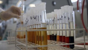 Anabolika-Doping könnte in Westdeutschland verbreiteter gewesen sein als angenommen