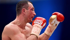 Klitschko hat gegen Fury ganz schön was abbekommen